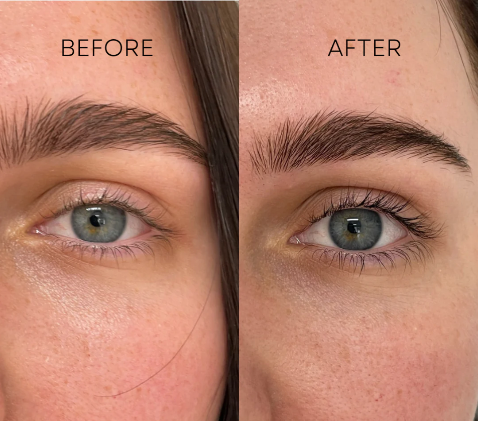 Alurisse Lash Growth Serum